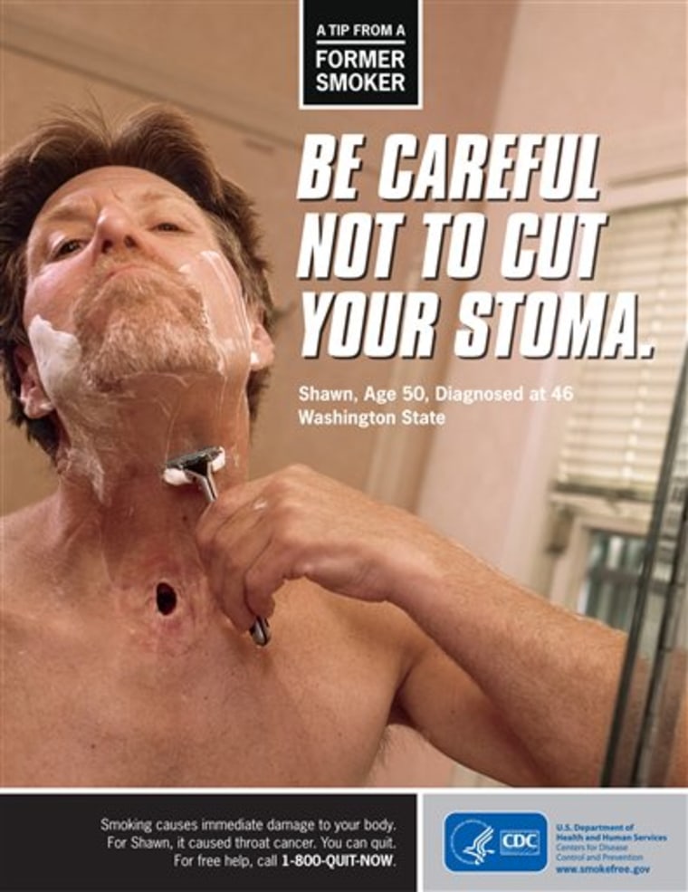 The new CDC ad shows Shawn Wright who had a tracheotomy after being diagnosed with head and neck cancer. 